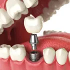 Business 3 image CAPE TOWN DENTIST Dentist in Cape Town WC