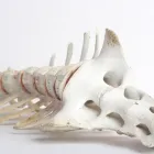 Maatskappy 4 beeld CHIROPRACTORS - DR SINDI LUDIK, DR MICHIEL OPPERMAN Wrist Pain in Pretoria GP