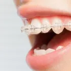 Maatskappy 2 beeld DR ANDRÉ DE VILLIERS Orthodontics in Cape Town WC