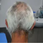 Maatskappy 3 beeld DR KATHERINE YORK Skin Specialists in Port Elizabeth EC