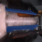 Maatskappy 4 beeld DR KATHERINE YORK Skin Specialists in Port Elizabeth EC