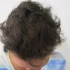 Maatskappy 5 beeld DR KATHERINE YORK Skin Specialists in Port Elizabeth EC