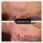 Business 1 image MEDISKIN LASER CLINIC Young Nails in Pretoria GP