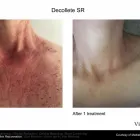 Business 2 image MEDISKIN LASER CLINIC Young Nails in Pretoria GP