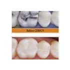 Maatskappy 11 beeld MYTEETH.CO.ZA Unlimited Whitening in Cape Town WC