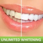 Maatskappy 13 beeld MYTEETH.CO.ZA Unlimited Whitening in Cape Town WC