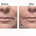 Business 1 image SUNROOM BRYANPARK Teeth Whitening in Johannesburg GP