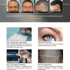 Business 7 image THE HAIRFRONT Hair Transplantation in Cape Town WC