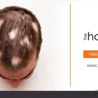 Business 9 image THE HAIRFRONT Hair Transplantation in Cape Town WC