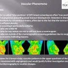Maatskappy 1 beeld THERMAL HEALTH CENTRE PTA EAST Thermography in Pretoria GP