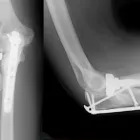 Business 3 image TOTAL SOLUTION MEDICAL Trauma in Pretoria GP