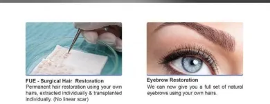 Business 7 image THE HAIRFRONT Hair Transplantation in Cape Town WC