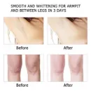 SKIN LIGHTENING,HIPS AND BUMS CREAMS +27658307017 tightening creams in Germiston GP